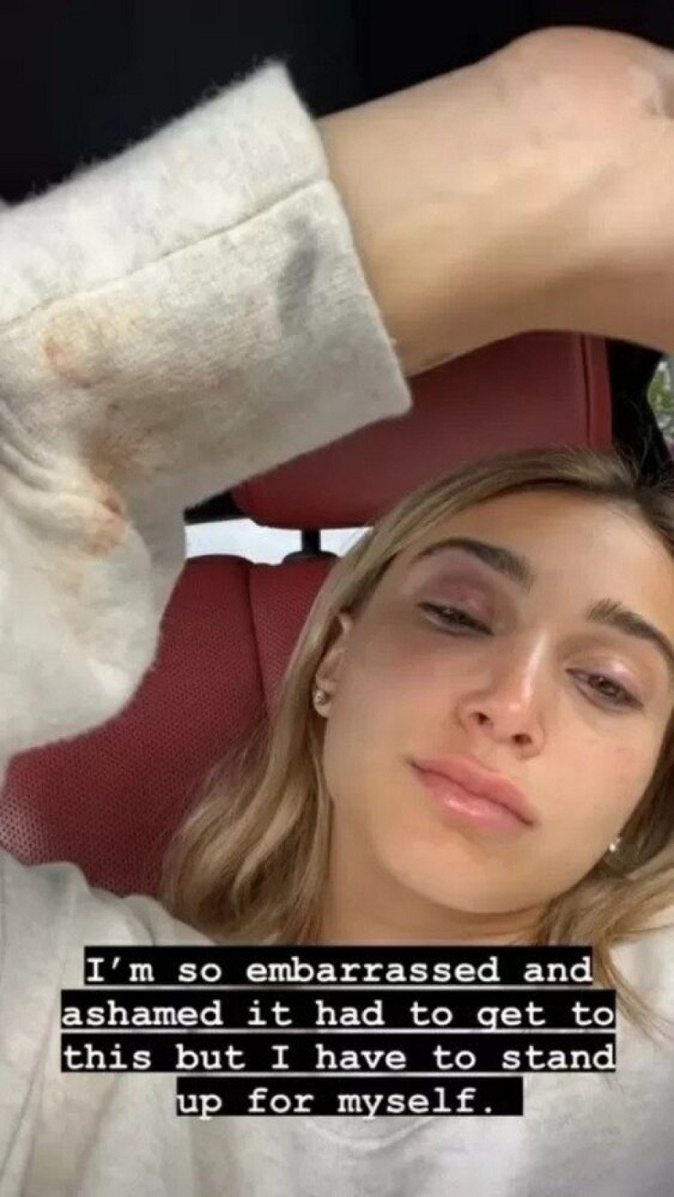 Ex-namorada de Tyga acusa rapper de agressão
