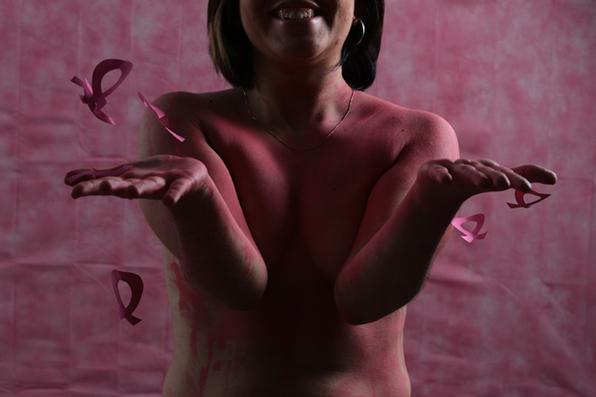 Em Pernambuco, em 2020, 801 mulheres faleceram em decorrência do câncer de mama e 315 por conta da neoplasia do colo do útero./Brenda Alacântara/Esp. DP Em Pernambuco, em 2020, 801 mulheres faleceram em decorrência do câncer de mama e 315 por conta da neoplasia do colo do útero./Brenda Alacântara/Esp. DP