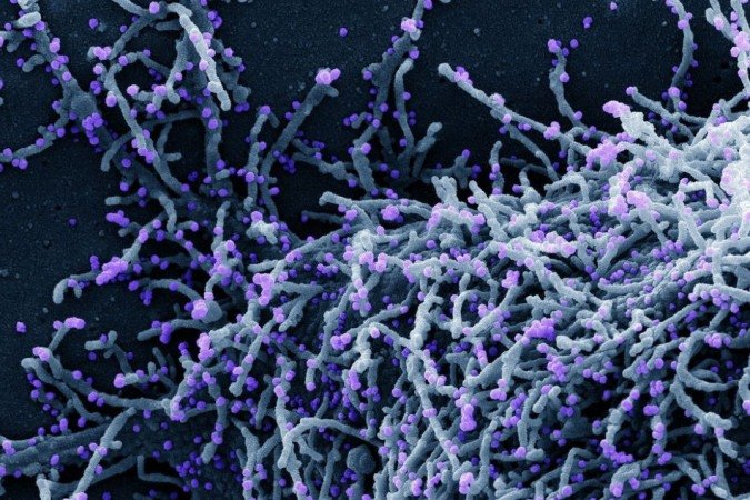 /Foto: National Institute of Allergy and Infectious Diseases /NIAID/Direitos reservados /Foto: National Institute of Allergy and Infectious Diseases /NIAID/Direitos reservados