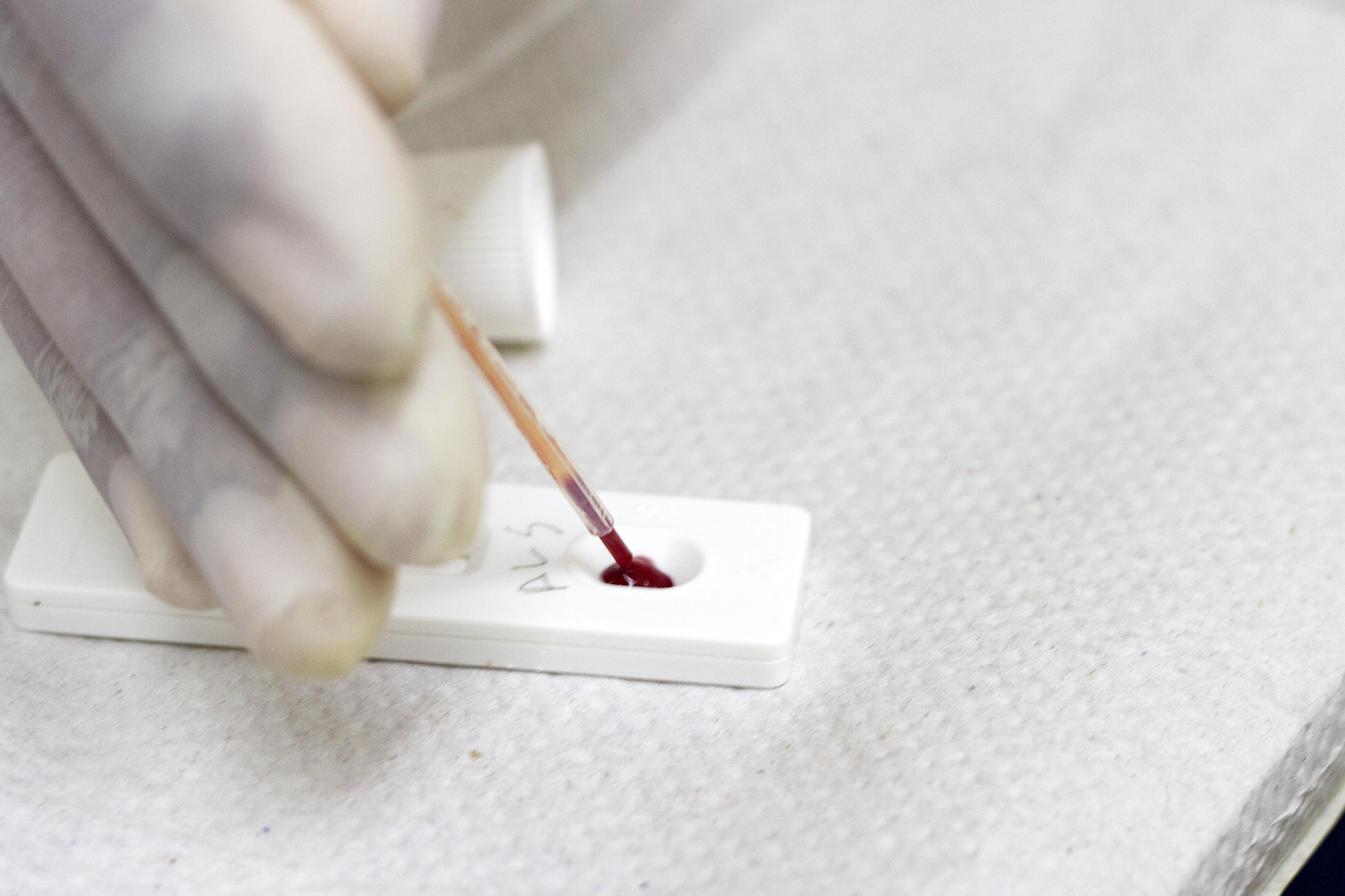 SES-PE realiza, nesta quarta (1º/12), a partir das 8h, testagem de HIV e hepatites em Jaboatão dos Guararapes no Dia Mundial da Aids. Ação terá a capacidade de acolher 60 pessoas./Miva Filho/SES-PE SES-PE realiza, nesta quarta (1º/12), a partir das 8h, testagem de HIV e hepatites em Jaboatão dos Guararapes no Dia Mundial da Aids. Ação terá a capacidade de acolher 60 pessoas./Miva Filho/SES-PE