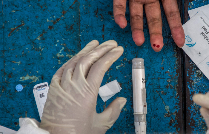 Os detalhes epidemiológicos serão repassados ao longo do dia pela Secretaria Estadual de Saúde./Foto: AFP