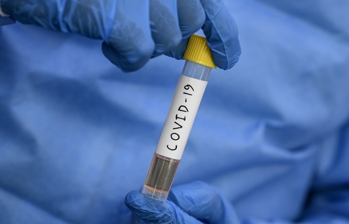 Os detalhes epidemiológicos serão repassados ao longo do dia pela Secretaria Estadual de Saúde./Foto: SAJJAD HUSSAIN/AFP Os detalhes epidemiológicos serão repassados ao longo do dia pela Secretaria Estadual de Saúde./Foto: SAJJAD HUSSAIN/AFP