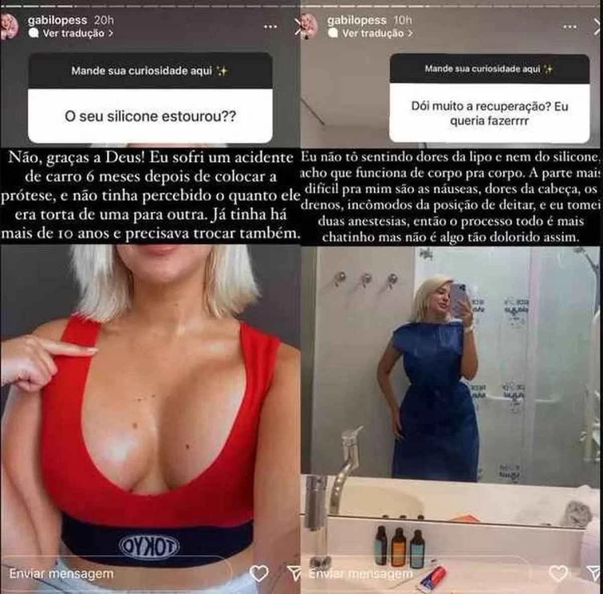 Gabi Lopes explicando seus procedimentos estéticos nas redes sociais