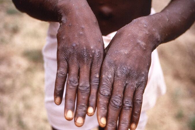 /Foto: CDC/Bryan W. J. Mahy