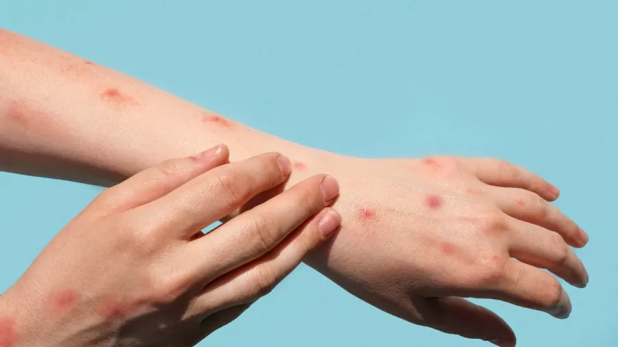 /Crédito: istock /Crédito: istock