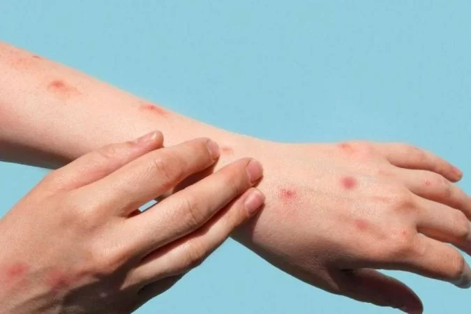 /Foto: iStock /Foto: iStock
