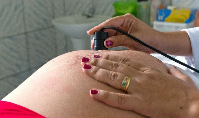 /Foto: Arquivo/MDS /Foto: Arquivo/MDS