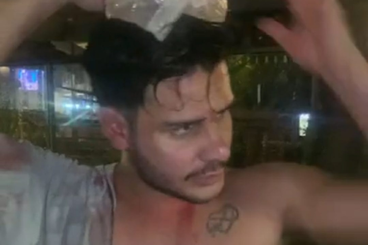 Após o episódio, Marcílio Gomes apareceu nas suas redes sociais com marcas de sangue e contou detalhes/Reprodução Após o episódio, Marcílio Gomes apareceu nas suas redes sociais com marcas de sangue e contou detalhes/Reprodução
