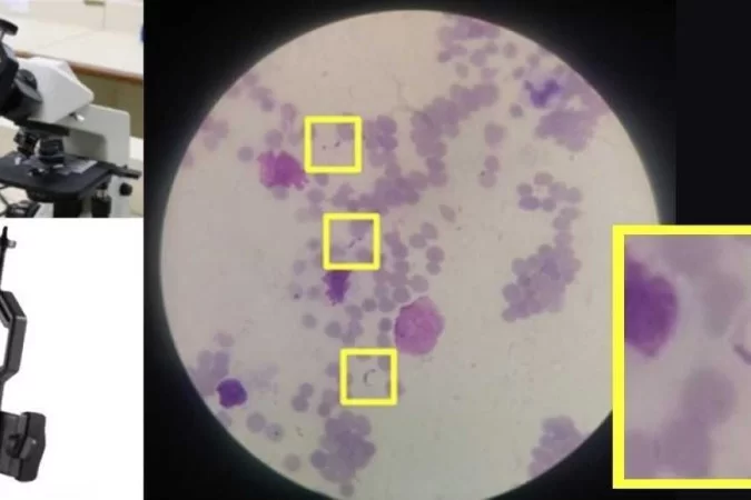 /Foto:bCenter of Research on Inflammatory Diseases /Foto:bCenter of Research on Inflammatory Diseases
