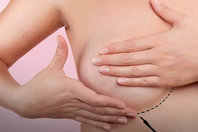 (Foto: Divulgação/ Sociedade brasileira de mastologia) /Foto: Divulgação/ Sociedade brasileira de mastologia