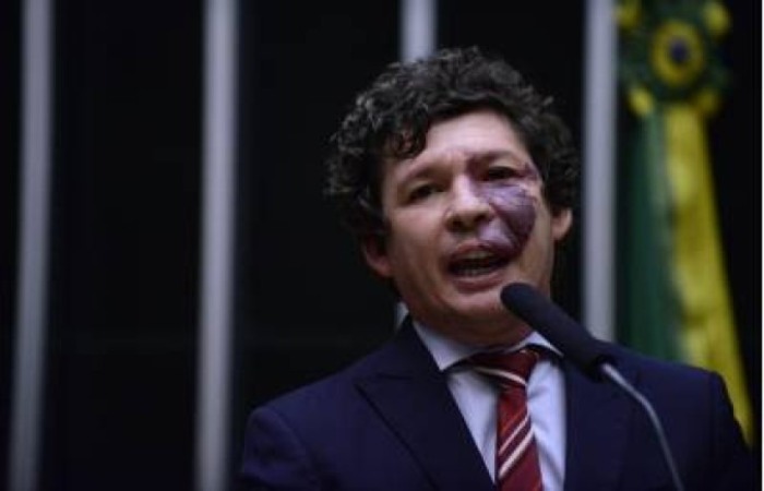 Após reunião do partido, que negocia a aprovação da PEC nas duas Casas Legislativas, lideranças do partido comentaram sobre o alinhamento com as demais legendas para agilizar a tramitação/Crédito: Nilson Bastian/Câmara dos Deputados Após reunião do partido, que negocia a aprovação da PEC nas duas Casas Legislativas, lideranças do partido comentaram sobre o alinhamento com as demais legendas para agilizar a tramitação/Crédito: Nilson Bastian/Câmara dos Deputados