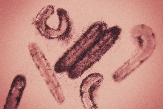 O marburg é um vírus da mesma família do ebola e tem uma alta mortalidade %u2014 em episódios anteriores, até 88% dos infectados morreram/Foto: Reprodução O marburg é um vírus da mesma família do ebola e tem uma alta mortalidade %u2014 em episódios anteriores, até 88% dos infectados morreram/Foto: Reprodução