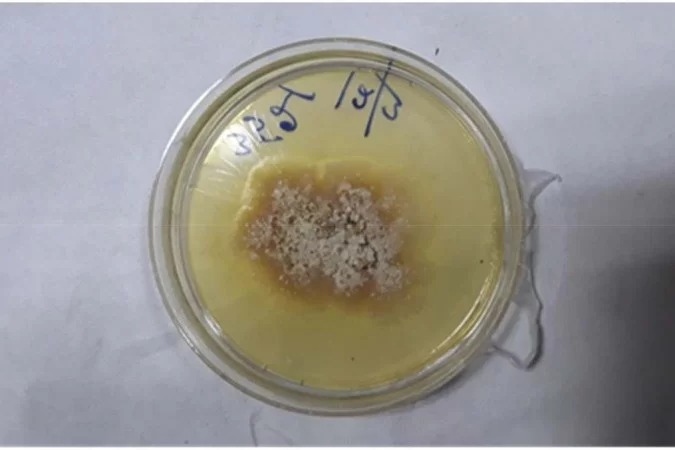 /Foto: Reprodução/Medical Mycology Case Reports /Foto: Reprodução/Medical Mycology Case Reports