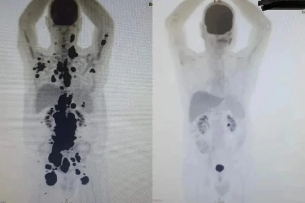 /Foto: Montagem-Instagram/Paulocfperegrino