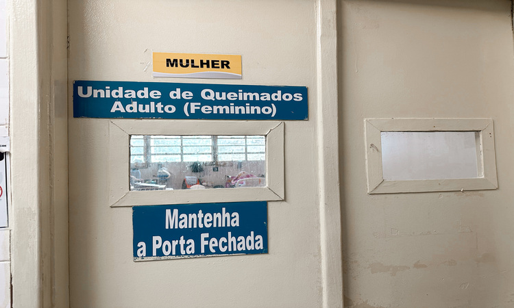 As três causas principais das queimaduras são: queimaduras por líquidos quentes, fogos de artifício e uso de combustíveis/Foto: Imprensa/HR