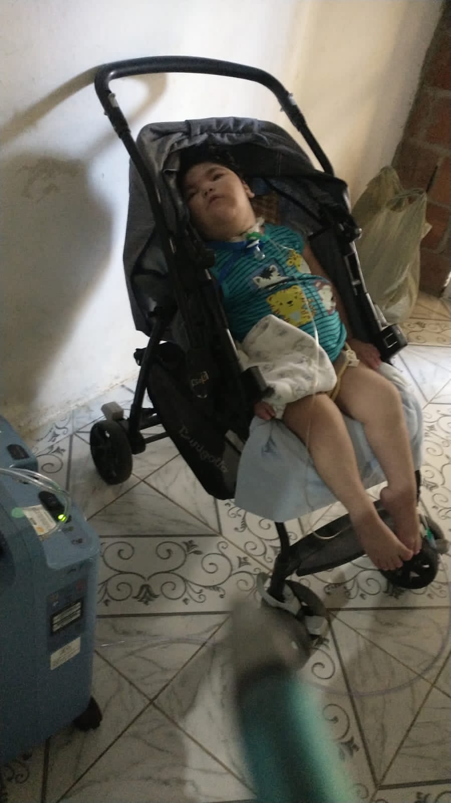 Bernardo Lucas Feitosa, de um ano e 10 meses, &eacute; portador da S&iacute;ndrome de West/Foto: Arquivo Pessoal