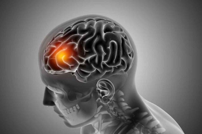 Mês de setembro é marcado pela conscientização do aneurisma cerebral/foto: Reprodução/Freepik/Kjpargeter Mês de setembro é marcado pela conscientização do aneurisma cerebral/foto: Reprodução/Freepik/Kjpargeter