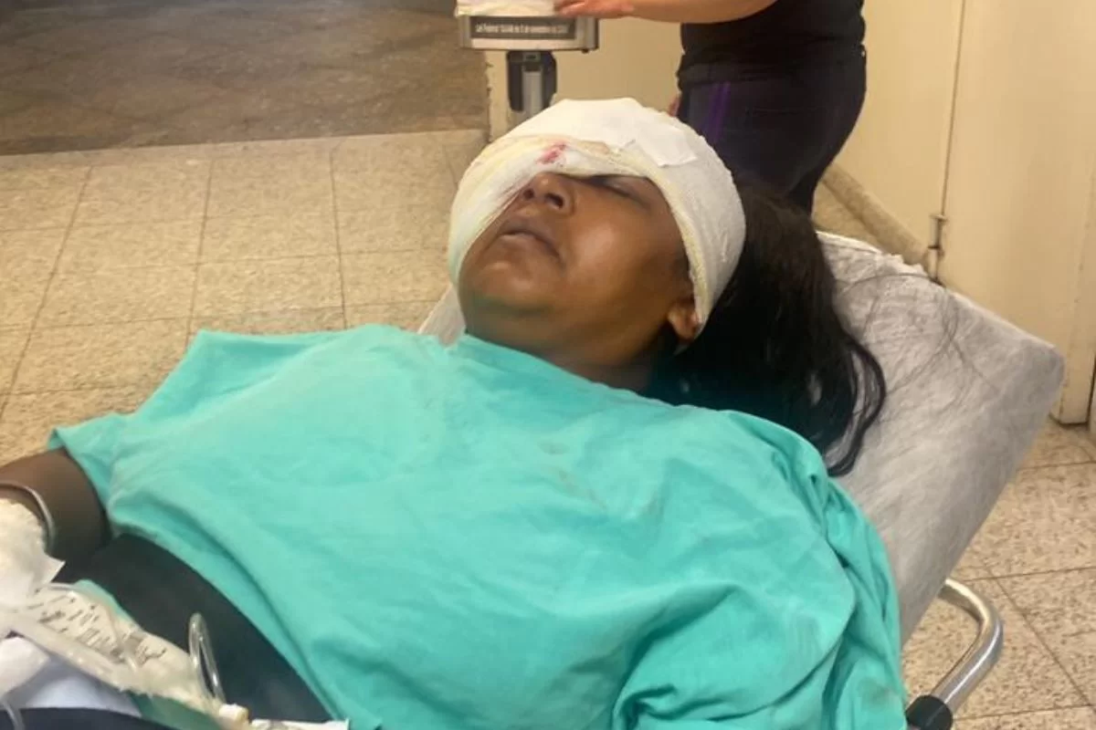 Daiane Cristina perdeu a visão do olho direito após ser baleada/foto: Acervo pessoal