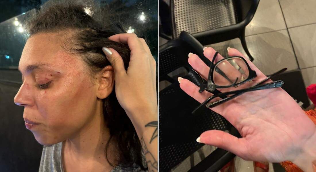 Leilane teve óculos quebrados