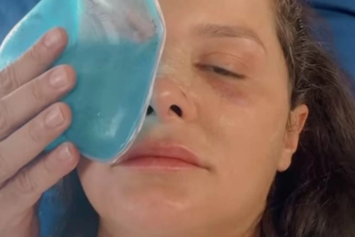 Maraisa contou, ainda, como foram os primeiros momentos após o acidente e revelou que precisou passar por uma cirurgia./Foto: Reprodução/Instagram Maraisa contou, ainda, como foram os primeiros momentos após o acidente e revelou que precisou passar por uma cirurgia./Foto: Reprodução/Instagram