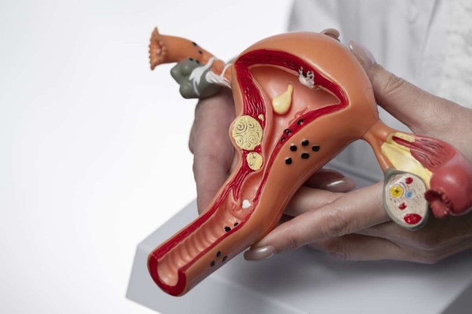 Saco de Douglas é um tecido que reveste anatomicamente o fundo da vagina da mulher, entre o útero e o reto/Crédito: Reprodução/Freepik Saco de Douglas é um tecido que reveste anatomicamente o fundo da vagina da mulher, entre o útero e o reto/Crédito: Reprodução/Freepik