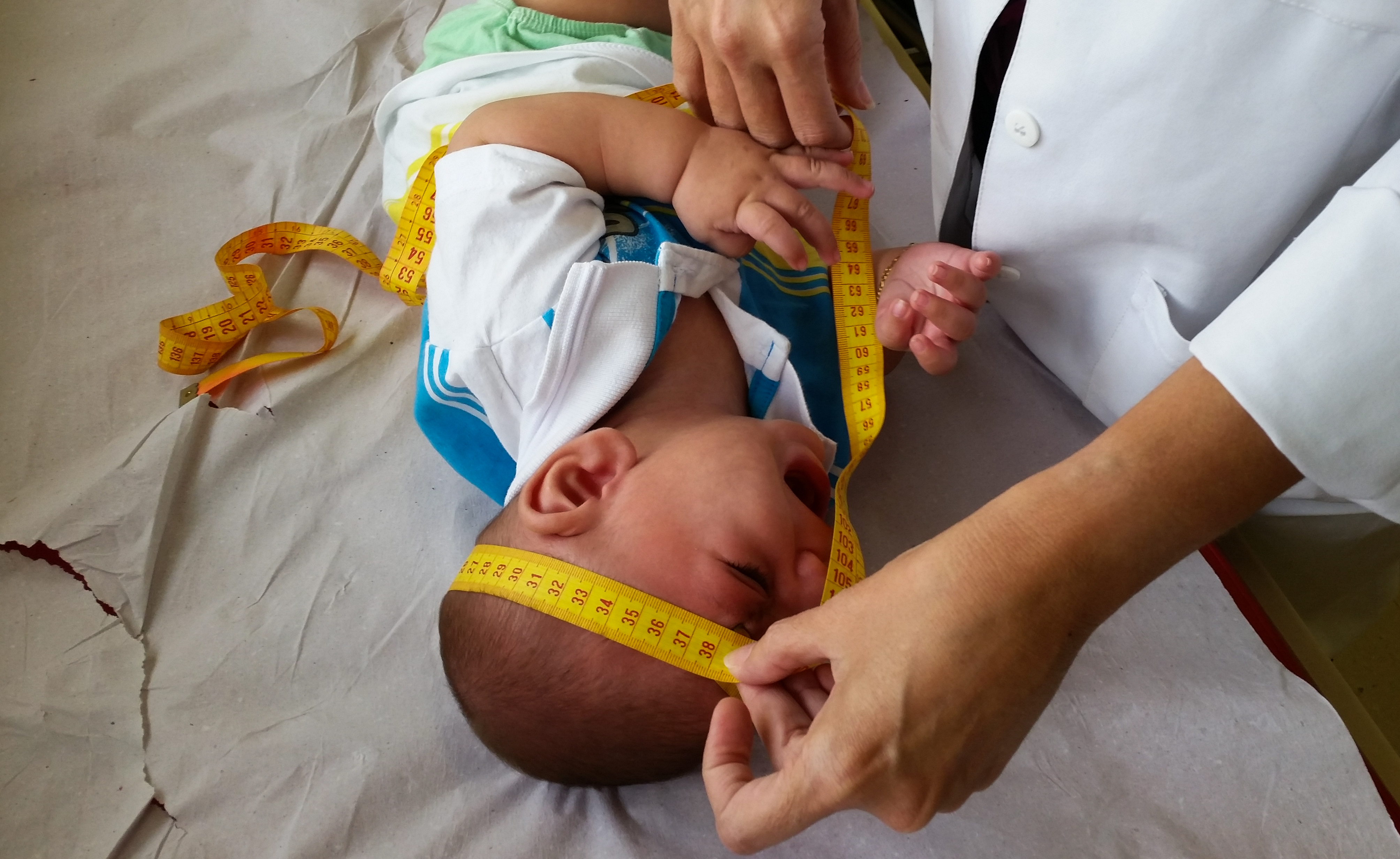 Os pacientes que serão beneficiados com o serviço possuem má formações ortopédicas graves causadas pela síndrome congênita do zika vírus/Foto: Sumaia Villela/Agência Brasil