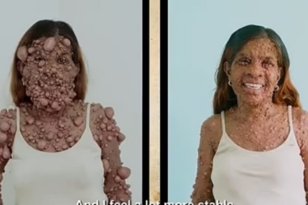 Ela disse que se sente uma mulher bonita e que agora pode respirar livremente