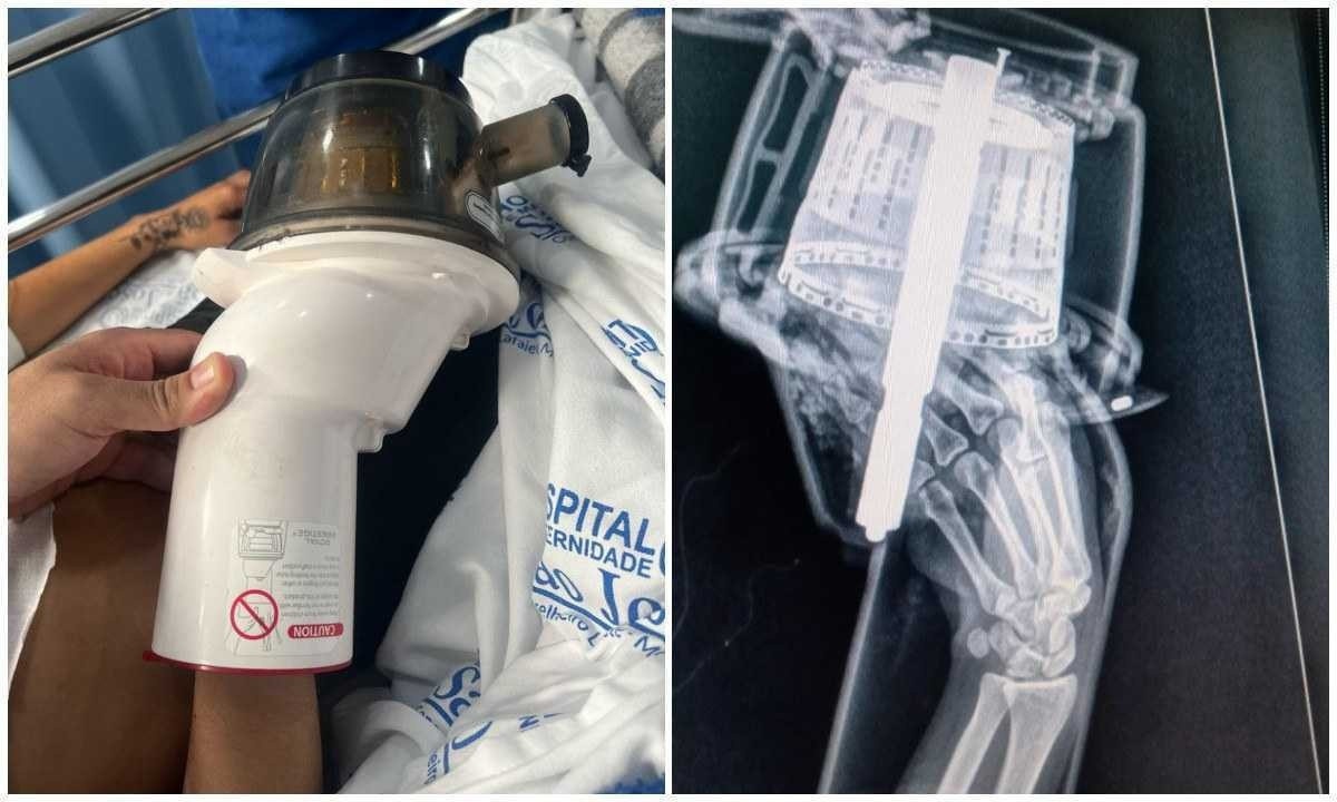 Vítima foi levada ao Hospital e Maternidade São José, no município/Foto: Divulgação/Corpo de Bombeiros