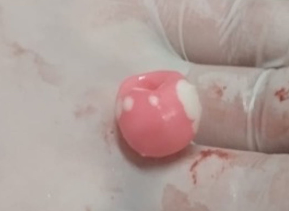 Pirulito foi encontrado depois de atendimento de bebê/Foto: PM/Divulgação
