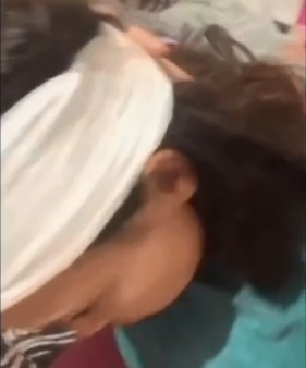 Alessandra ficou com cabeça enfaixada/Foto: Redes Sociais
