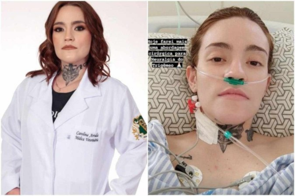 A recuperação é feita em regime de enfermaria, com analsegia para a manipulação local/Crédito: Reprodução/Instagram/@caarrudar A recuperação é feita em regime de enfermaria, com analsegia para a manipulação local/Crédito: Reprodução/Instagram/@caarrudar