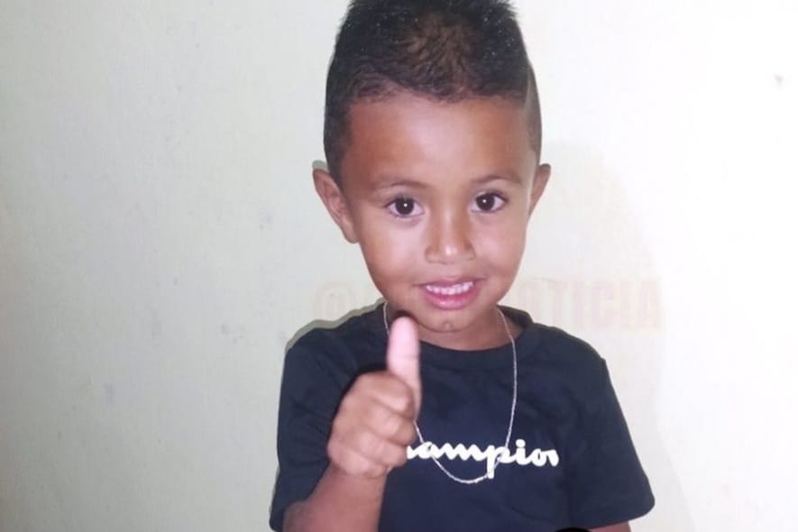 A princípio, o menino foi levado para a unidade de saúde Jamaci de Medeiros (24h) em Ponte dos Carvalhos, onde recebeu o atendimento médico, mas precisou ser transferido para o HR/Foto: Divulgação/SES