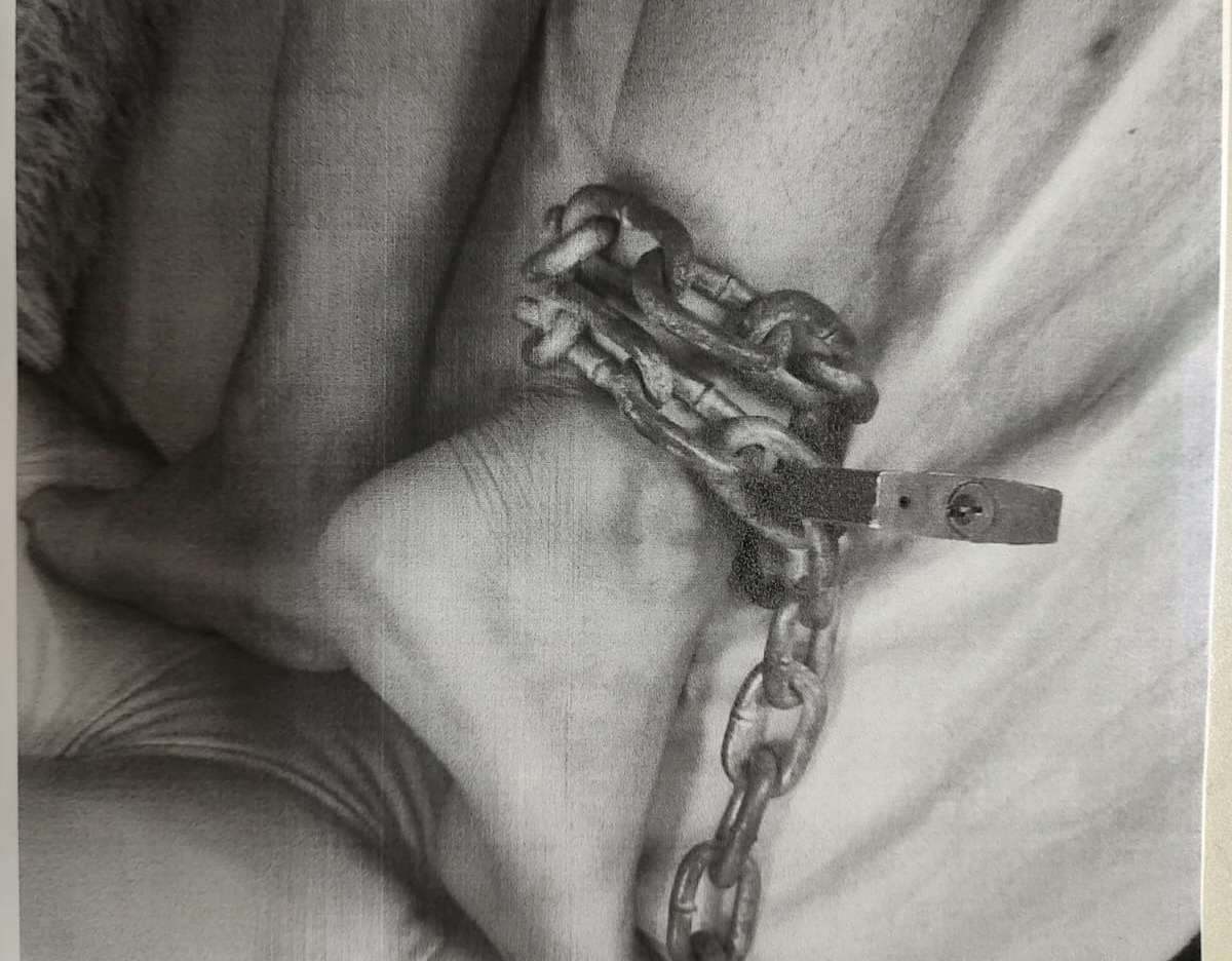 Após as lesões do castigo físico desaparecerem, a adolescente retornou à escola e conseguiu passar para a professora, imagens que a genitora fez, registrando as agressões/Foto: Arquivo/DP Após as lesões do castigo físico desaparecerem, a adolescente retornou à escola e conseguiu passar para a professora, imagens que a genitora fez, registrando as agressões/Foto: Arquivo/DP