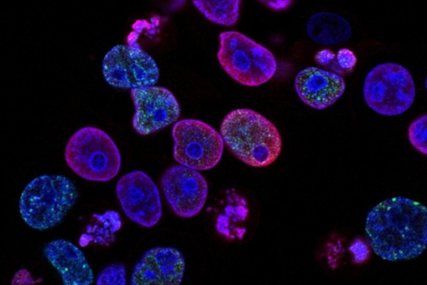 Com o uso de tecnologias, a equipe de Siepel criou códigos de barras em células para rastrear as rodovias pelas quais o câncer de próstata se espalha pelo corpo/Crédito: National Cancer Institute/Unsplash Com o uso de tecnologias, a equipe de Siepel criou códigos de barras em células para rastrear as rodovias pelas quais o câncer de próstata se espalha pelo corpo/Crédito: National Cancer Institute/Unsplash
