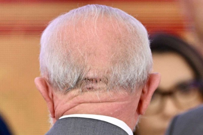 Antes de ir ao Planalto nesta sexta, o presidente fez novos exames no hospital Sírio Libanês, em Brasília. Segundo o boletim médico emitido pelo hospital, o novo exame de imagem da cabeça do presidente apresentou resultados estáveis/foto: EVARISTO SA / AFP Antes de ir ao Planalto nesta sexta, o presidente fez novos exames no hospital Sírio Libanês, em Brasília. Segundo o boletim médico emitido pelo hospital, o novo exame de imagem da cabeça do presidente apresentou resultados estáveis/foto: EVARISTO SA / AFP