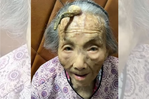 Apesar de ser exótico, a chinesa Chen não é a única mulher a ter ''chifres''/Crédito: Freepik Apesar de ser exótico, a chinesa Chen não é a única mulher a ter ''chifres''/Crédito: Freepik