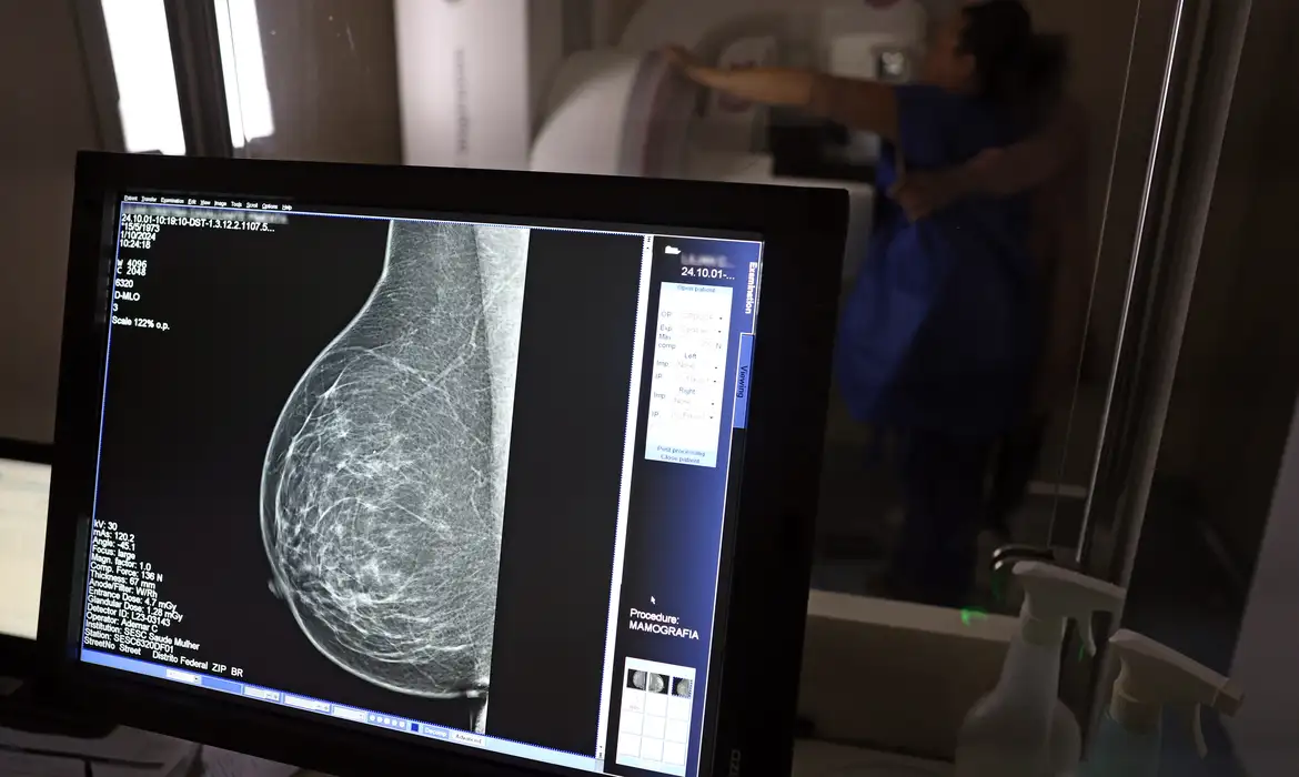 Segundo o CBR, a mamografia figura atualmente como um dos exames mais eficazes para detecção do câncer de mama em fase inicial/foto: José Cruz/Agência Brasil Segundo o CBR, a mamografia figura atualmente como um dos exames mais eficazes para detecção do câncer de mama em fase inicial/foto: José Cruz/Agência Brasil