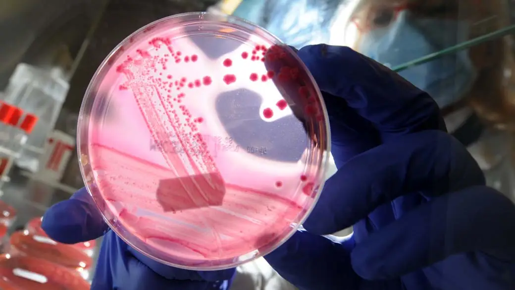 Lista publicada pela OMS contém 17 agentes patogênicos/foto: ChristIan Charisius/AFP
Leia mais em: https://veja.abril.com.br/saude/brasileiros-investigam-bacteria-causadora-de-infeccao-em-hospitalizados Lista publicada pela OMS contém 17 agentes patogênicos/foto: ChristIan Charisius/AFP
Leia mais em: https://veja.abril.com.br/saude/brasileiros-investigam-bacteria-causadora-de-infeccao-em-hospitalizados