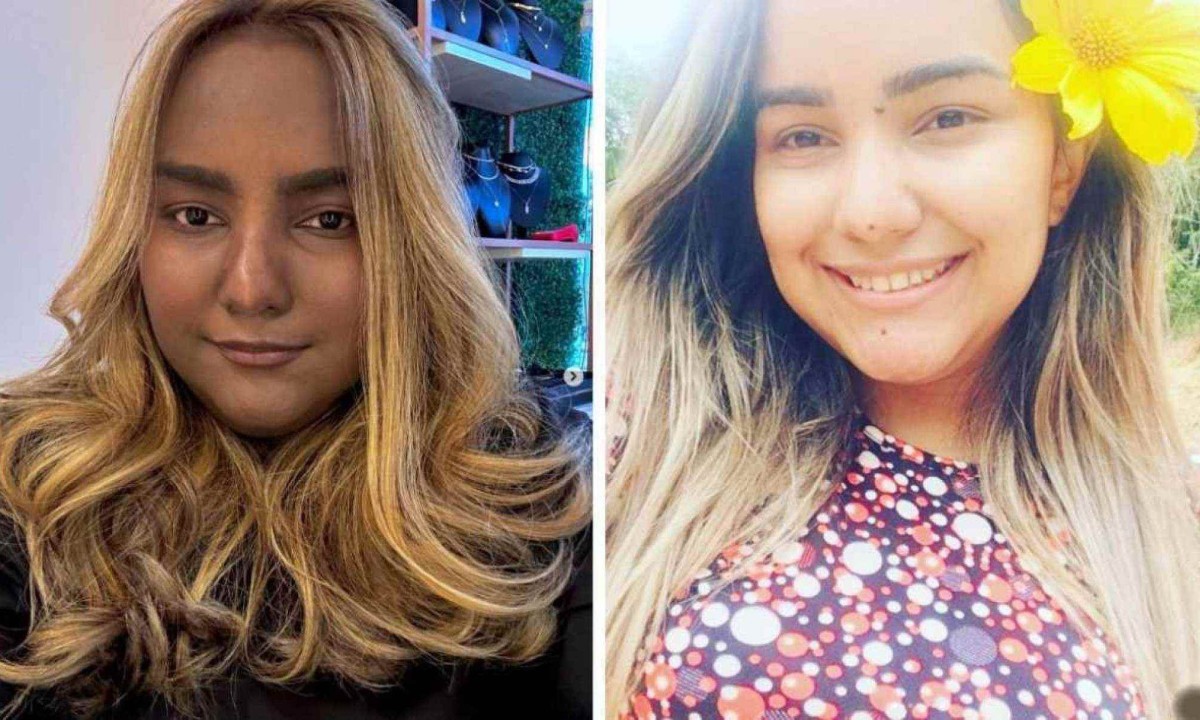 Sabrina teve alterações na cor de pele devido à Síndrome de Cushing e a um tumor raro no tórax/foto: Reprodução/Instagram
