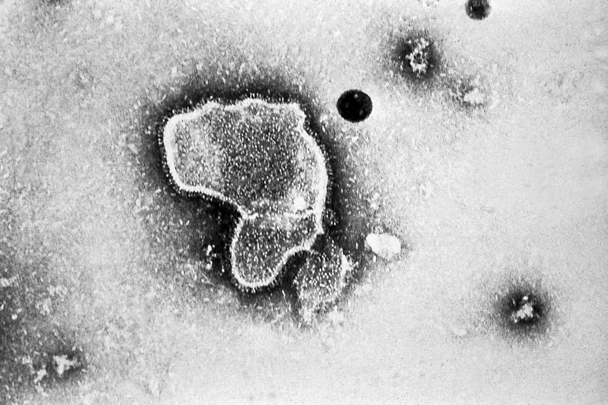 O vírus é da mesma família do sincicial respiratório (VSR)/foto: CDC/EUA O vírus é da mesma família do sincicial respiratório (VSR)/foto: CDC/EUA