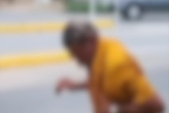 Idoso foi mordido no rosto e em uma perna