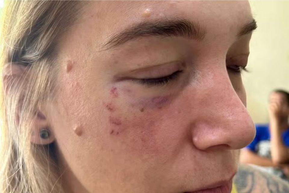 Fotógrafa Laura Philippsen, de 34 anos/Crédito: Reprodução