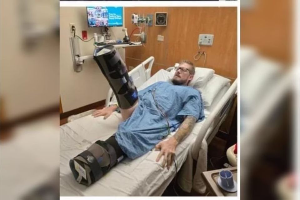 Max Armstrong, de 40 anos, sofreu sepse após uma queimadura aparentemente simples evoluir e obrigá-lo a amputar as duas pernas