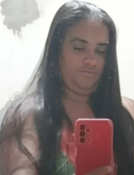 Rose ficou ferida após agressão do ex-companheiro/Foto: Redes Sociais Rose ficou ferida após agressão do ex-companheiro/Foto: Redes Sociais