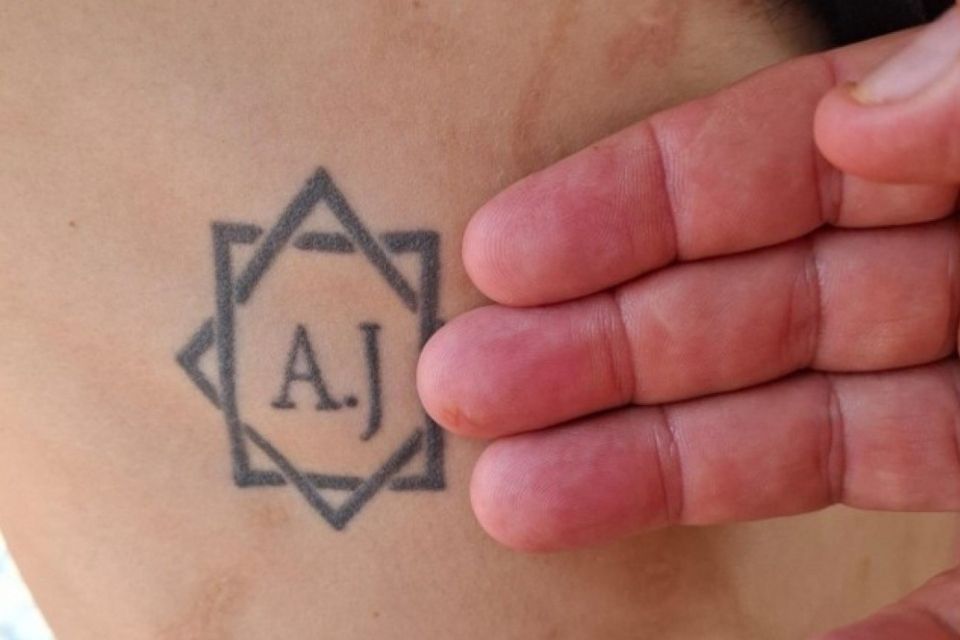 Tatuagem no corpo de uma das vítimas resgatadas em condição análoga à escravidão, em Minas Gerais, com as iniciais de dois dos empregadores/foto: Auditoria-Fiscal do Trabalho/Divulgação Tatuagem no corpo de uma das vítimas resgatadas em condição análoga à escravidão, em Minas Gerais, com as iniciais de dois dos empregadores/foto: Auditoria-Fiscal do Trabalho/Divulgação