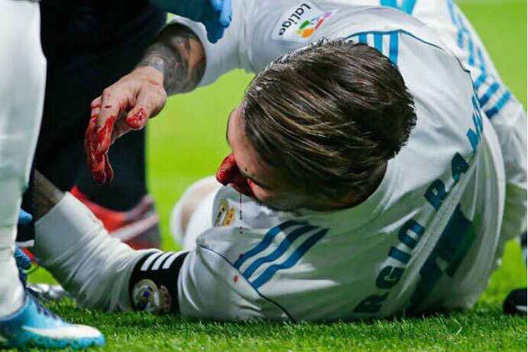 Sérgio Ramos sofreu uma pancada de Lucas Hernández no nariz durante o clássico com o Atlético