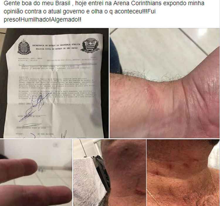 Nas redes sociais, torcedor corintiano relatou agressão policial