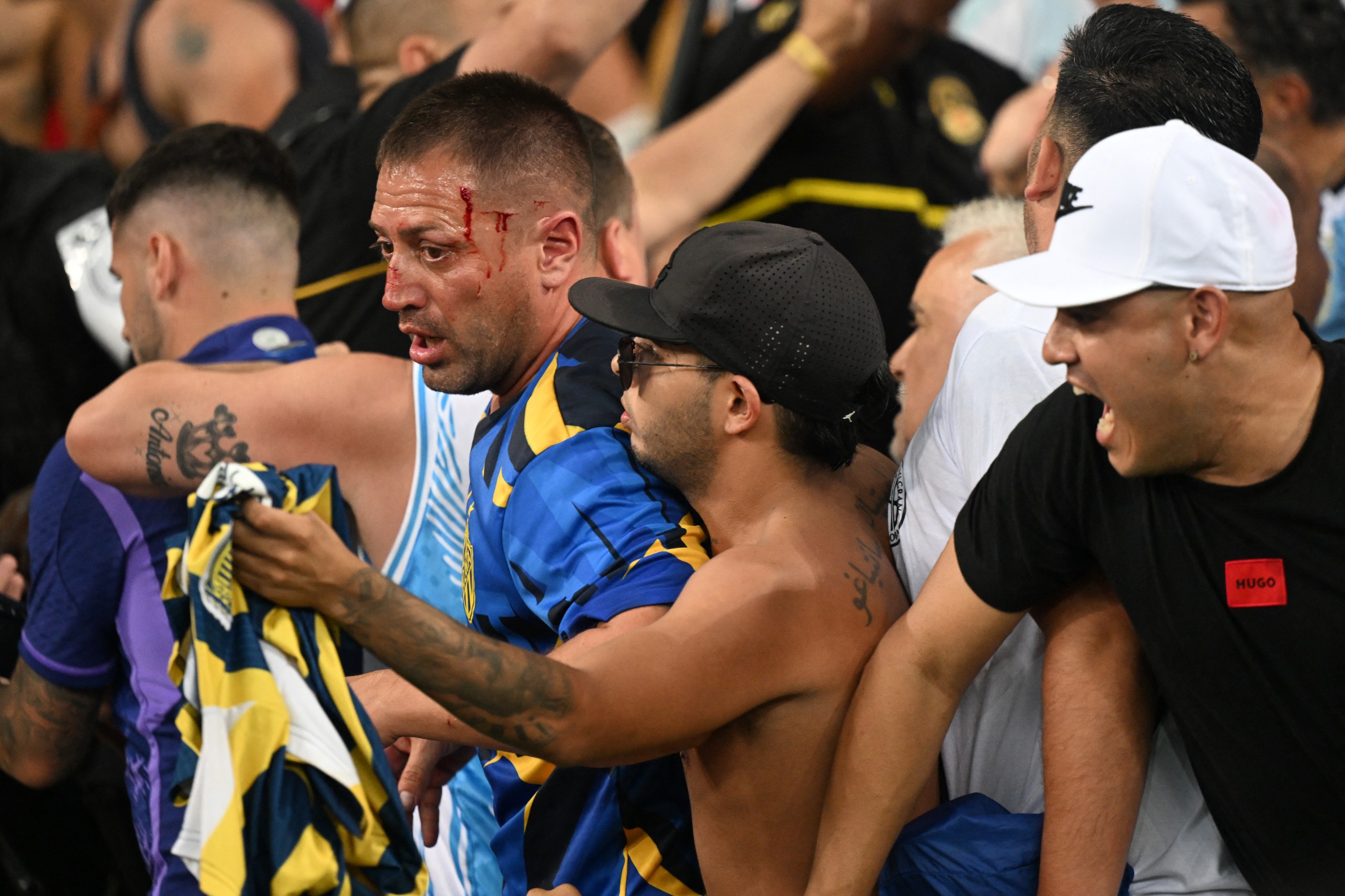 Muitos argentinos ficaram feridos