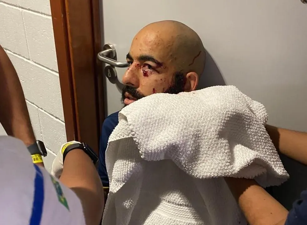 Goleiro Danilo Fernandes, do Bahia, sofreu escoriações no rosto com os estilhaço da bomba, em 2022