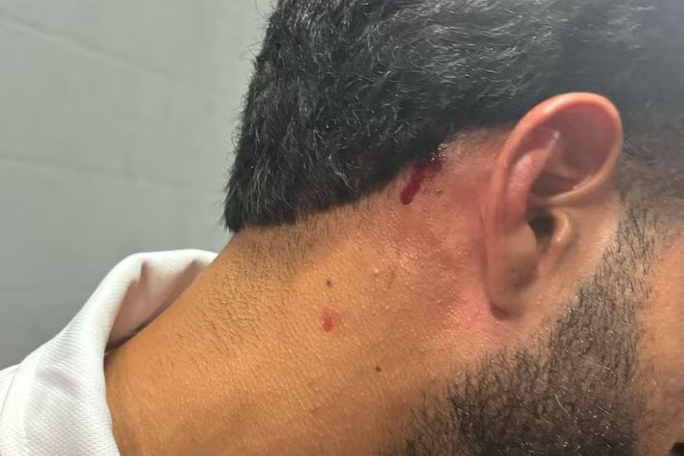 Vice-Presidente do Náutico cobra punições após pedrada em massagista
